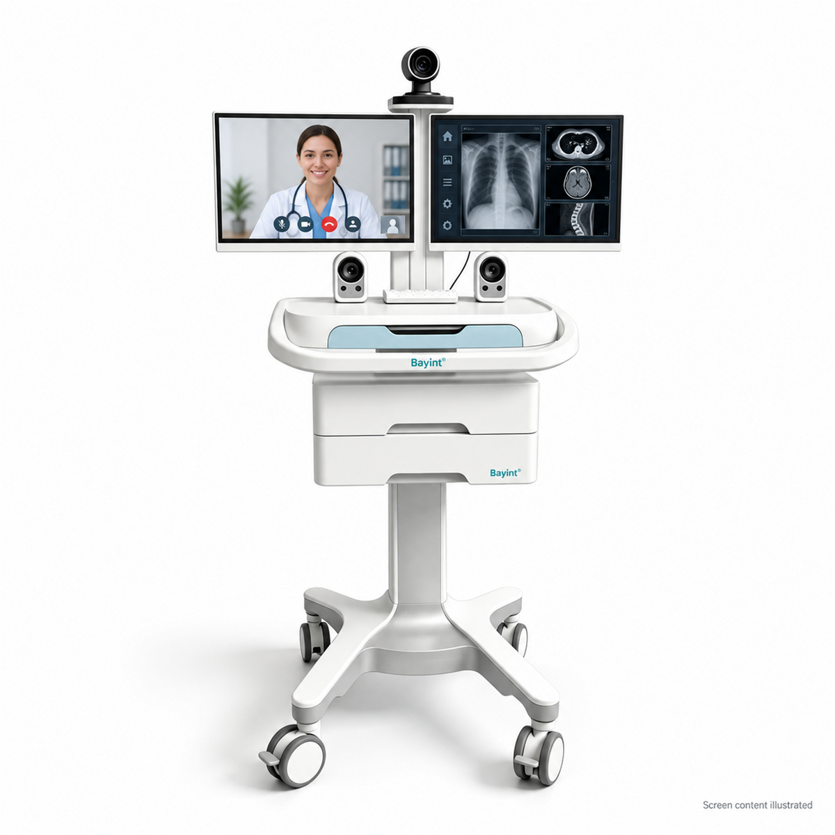 Brightened Bayint dual-screen telemedicine trolley with illustrative screen content